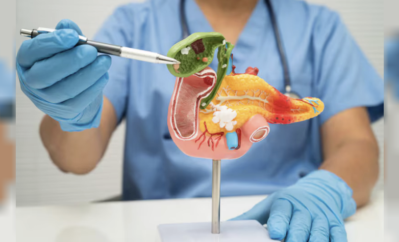 Avances contra el cáncer de páncreas