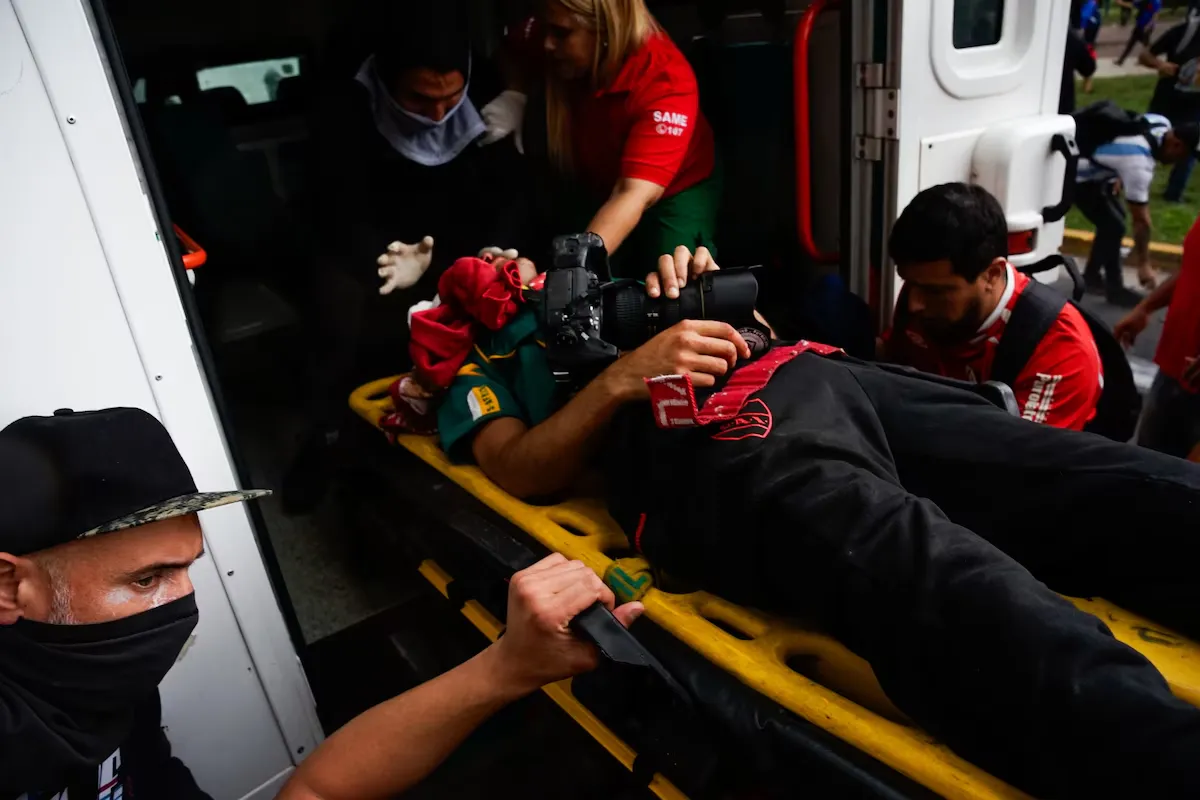 El fotógrafo atacado por policías sigue luchando por su vida