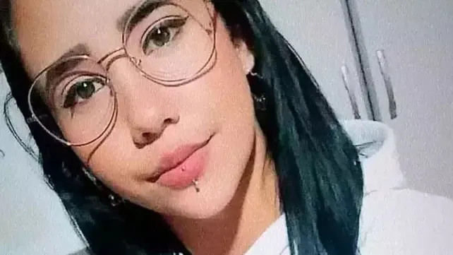 Andressa Souza, de 20 años, se puso un piercing en los labios, se le infectó y murió. 